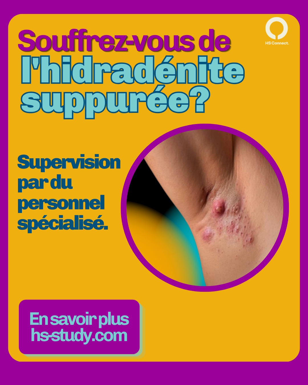 Possibilité d’étude clinique pour l’hidradénite suppurée au Canada