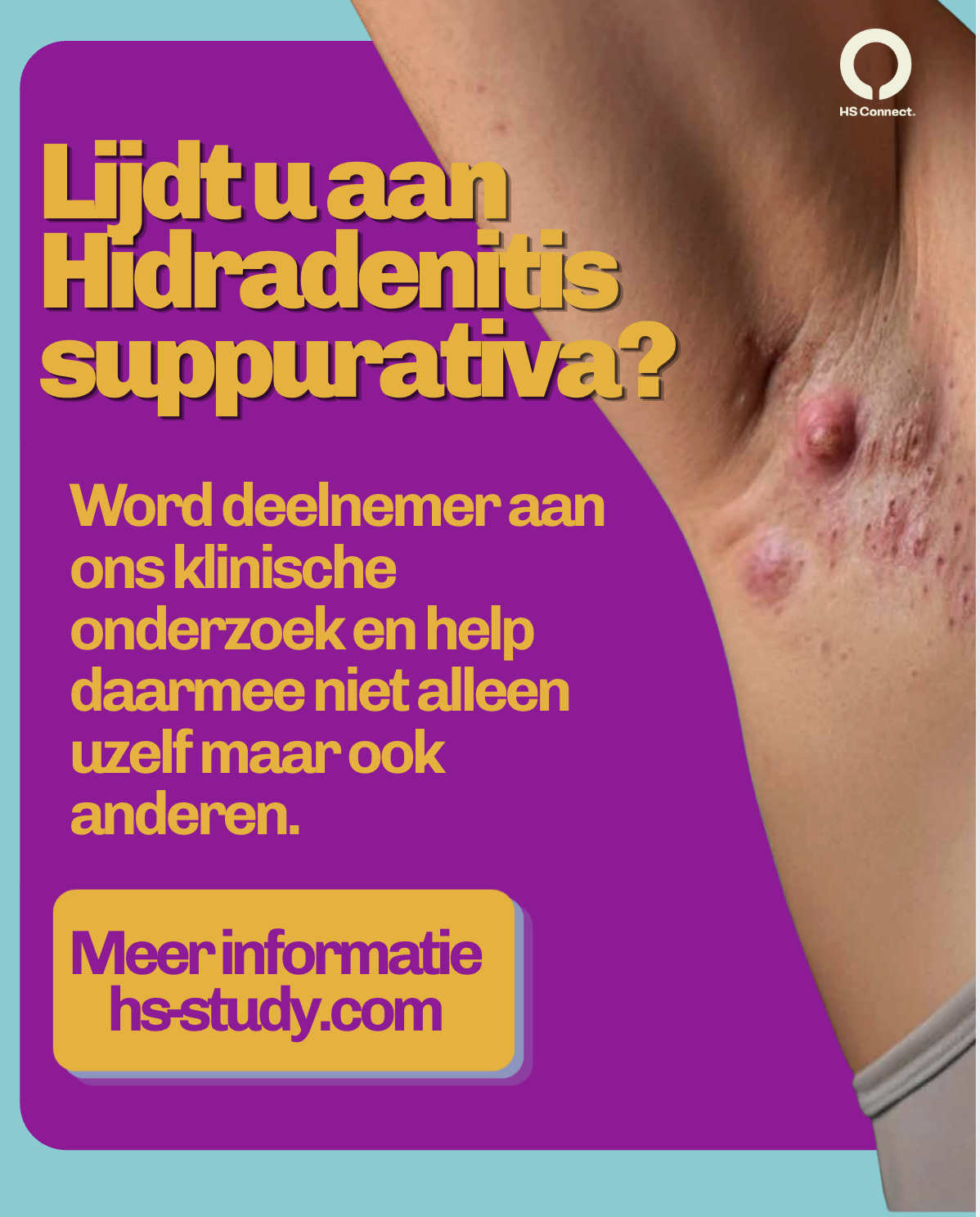 Klinisch onderzoek naar Hidradenitis suppurativa