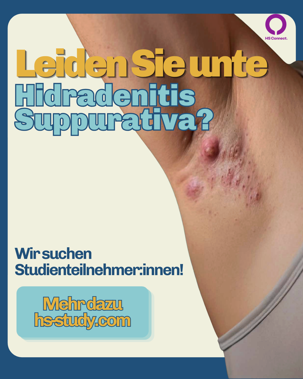 Klinische Studie zu Hidradenitis Suppurativa